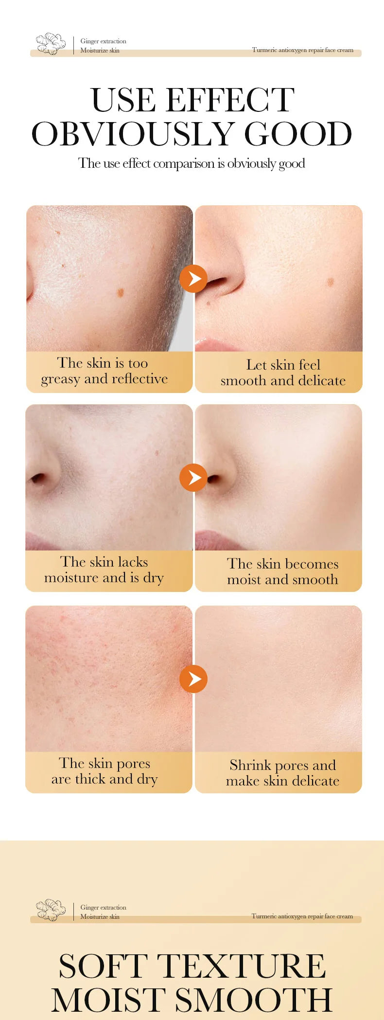 Natural Handmade Turmeric Soap Face Cream Serum Skin Care Set Clean Cutin Oil Control Removal Acne Whitening Remove Dark Spots - She Vibess By C2P